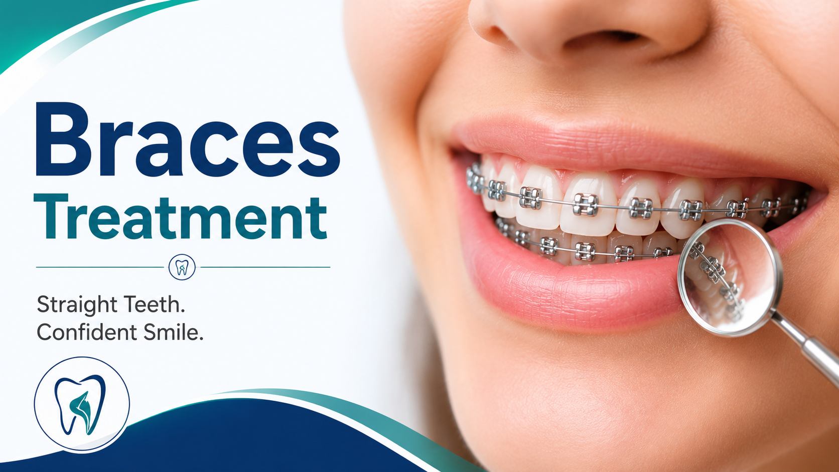 Braces