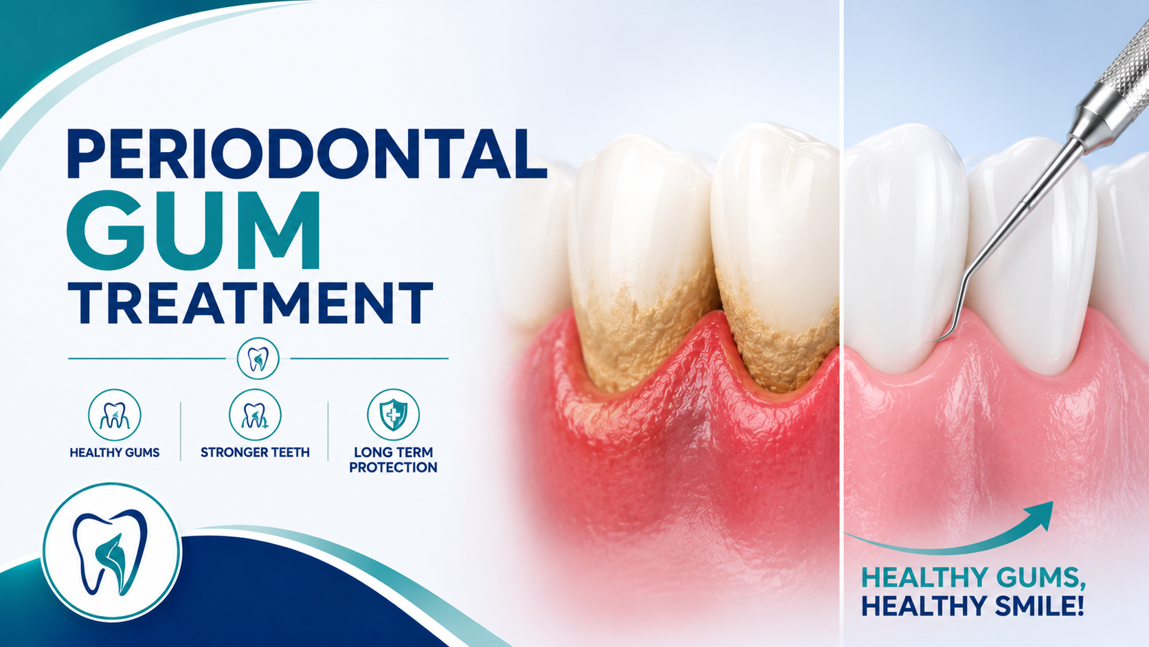 Periodontal Gum Treatment