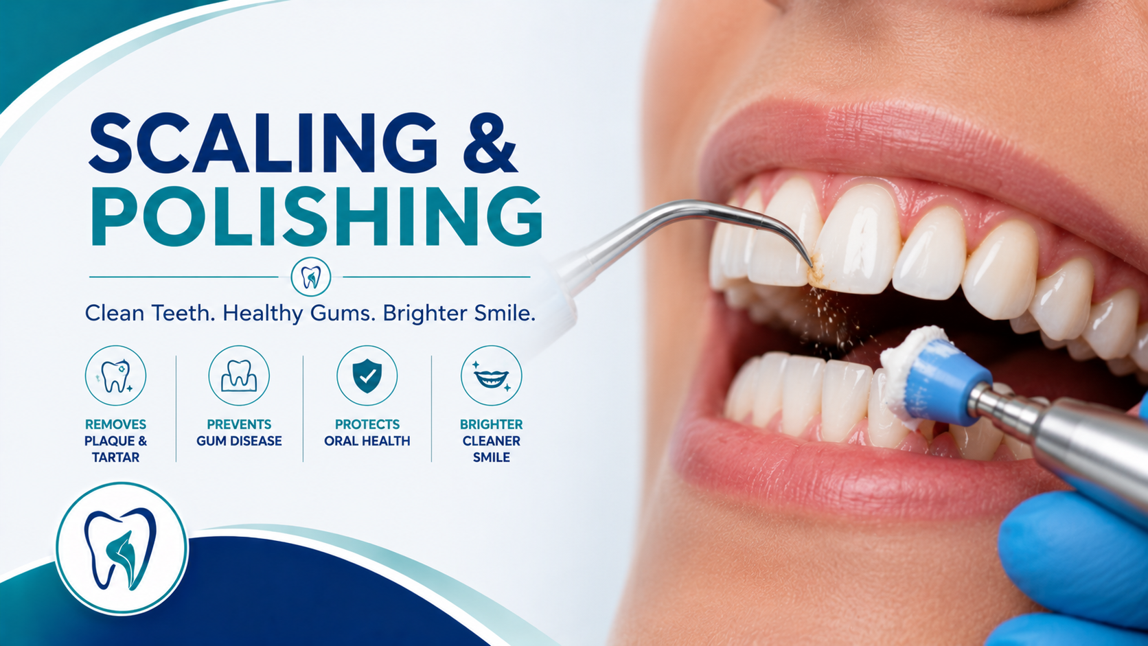 Scaling and Polishing