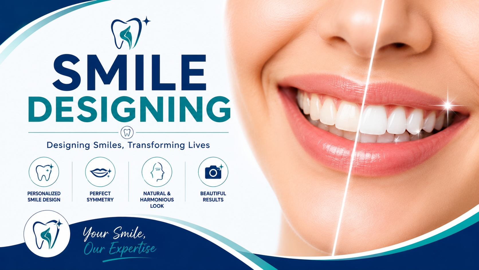 Smile Designing