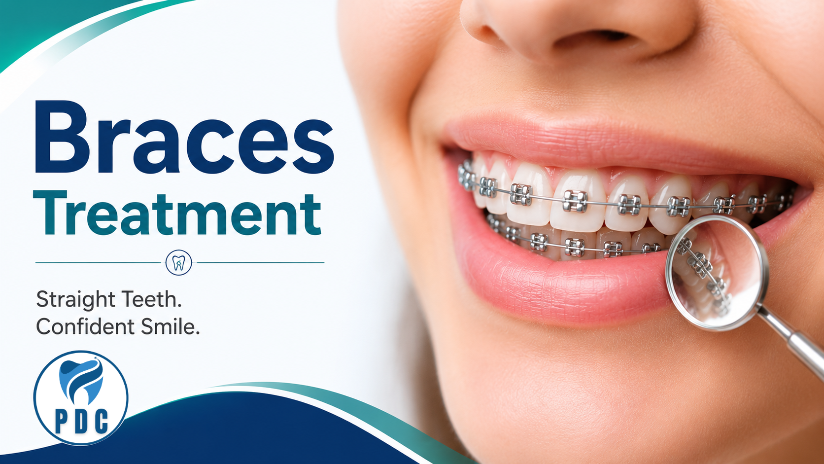 Braces