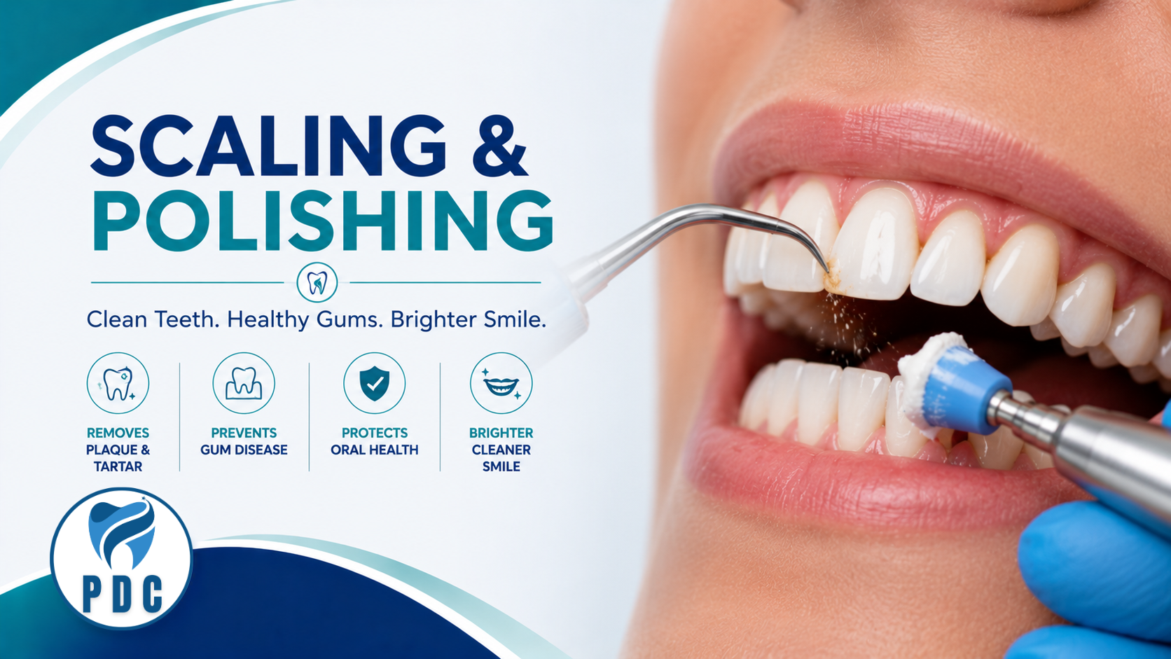 Scaling and Polishing