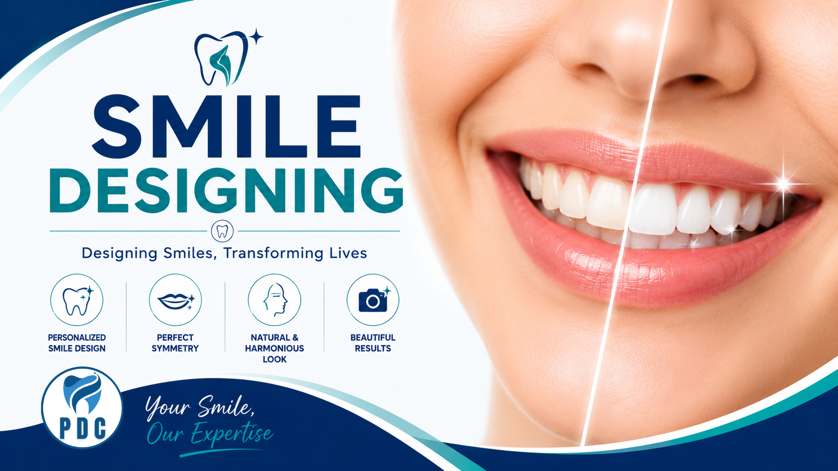 Smile Designing