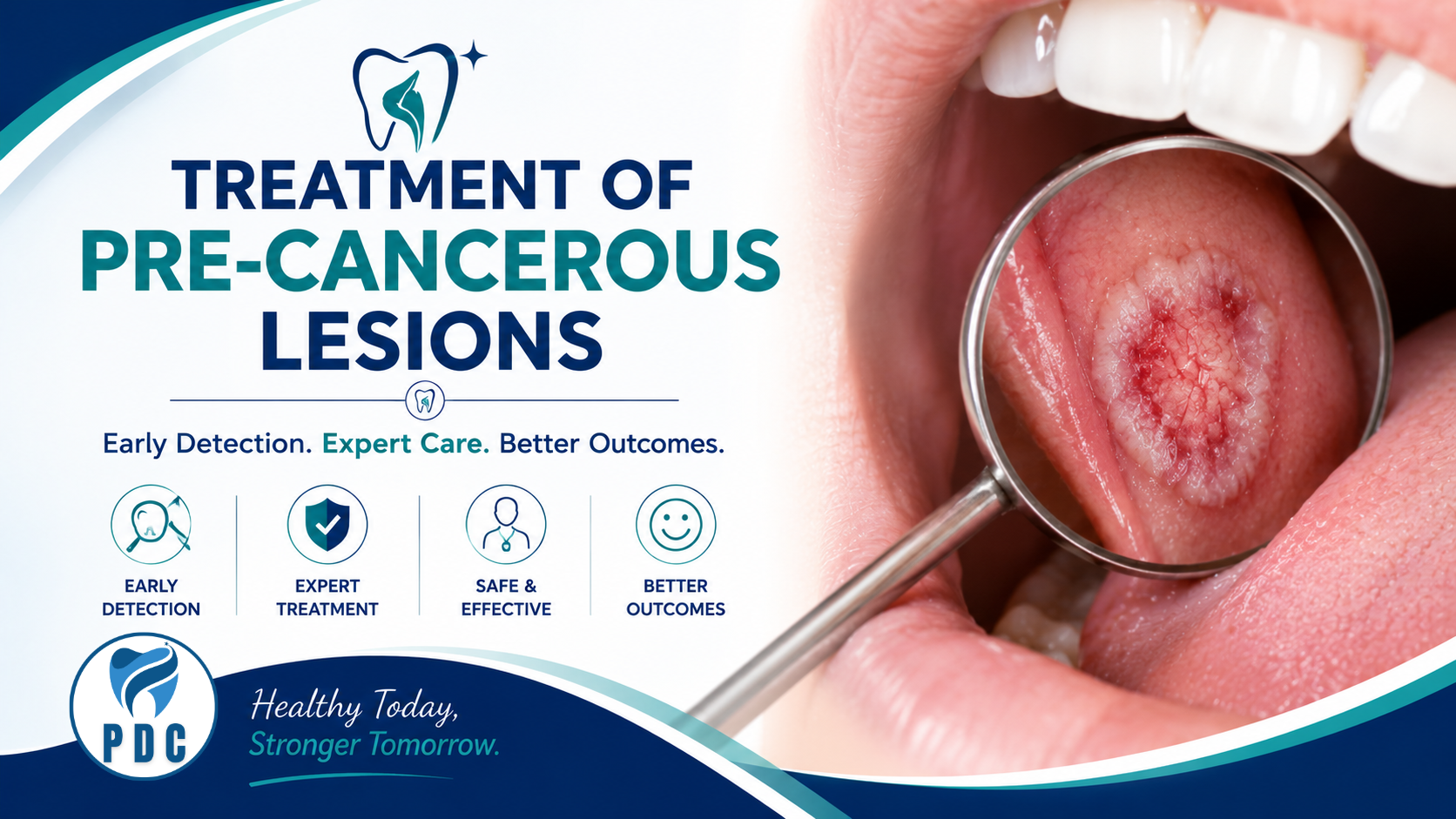 Treatment of Pre-Cancerous Lesions